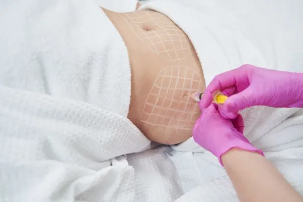 image of fat dissolving injections on love handles to help combat weight gain Lyme Regis