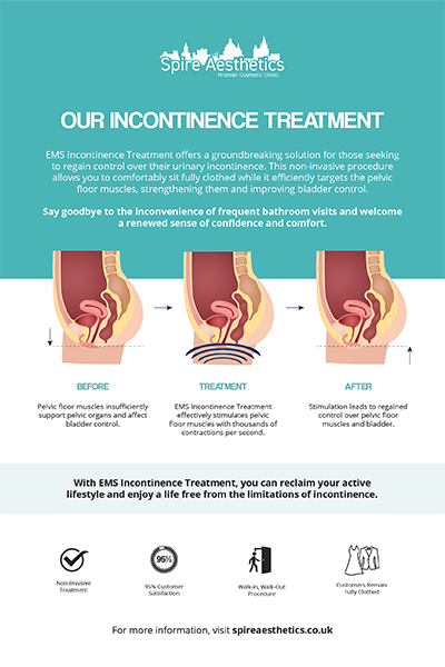 image of how urge incontinence Lyme Regis treatment works