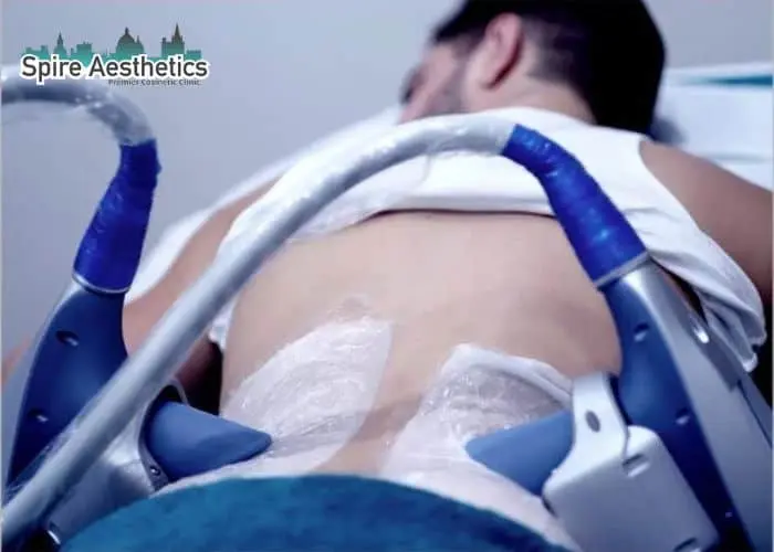 Man having fat freezing treatment done on love handles before a competitions Lyme Regis to create a sculpted look.
