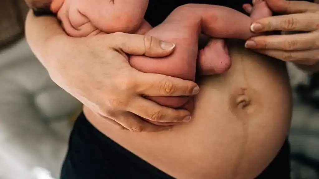 Why Is My Stomach Still Big After Pregnancy Lyme Regis?